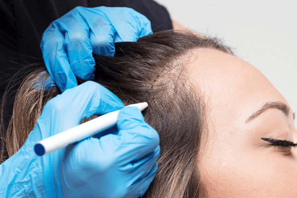 kadinlar-icin-sac-ekimi-img3