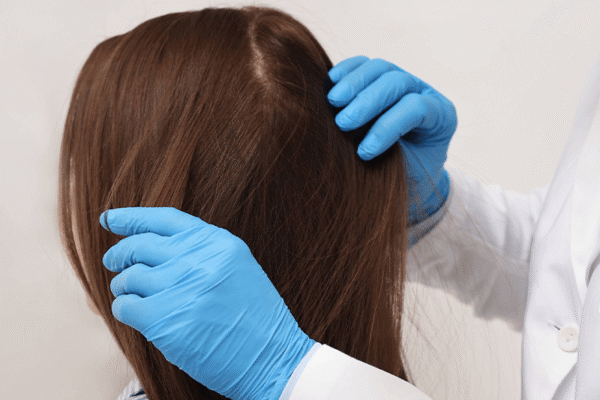 kadinlar-icin-sac-ekimi-img4