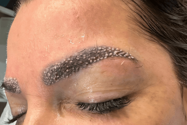 kas-ekimi-img2 kas-ekimi-img2