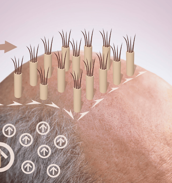 Sac ekim cesitleri img 600x640