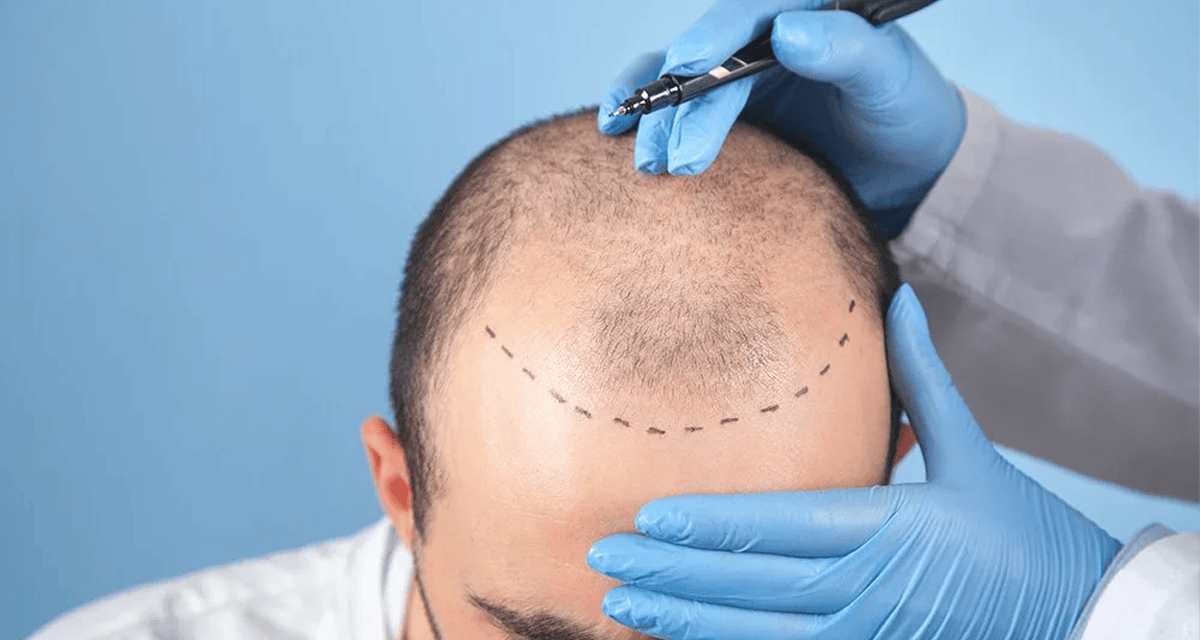 Sac ekimi agrilimi img