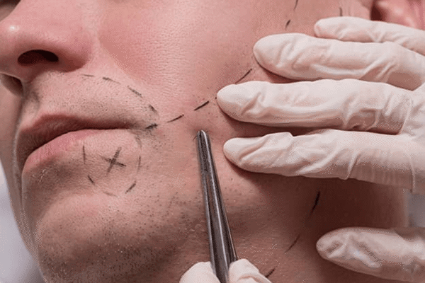 sakal-ekim-img1 sakal-ekim-img1