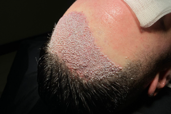 trassiz-ekim-img1 trassiz-ekim-img1